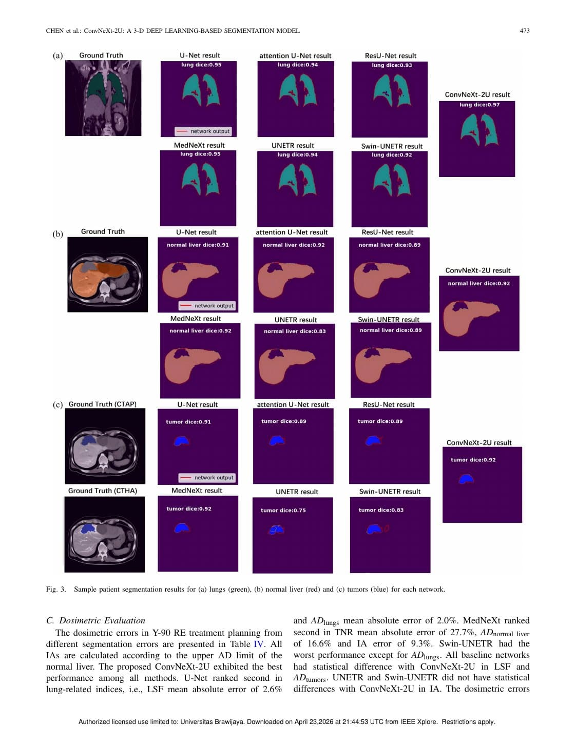 Halaman 6 dari paper ConvNeXt-2U