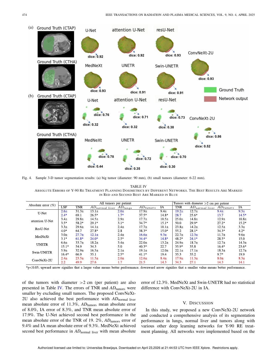 Halaman 7 dari paper ConvNeXt-2U